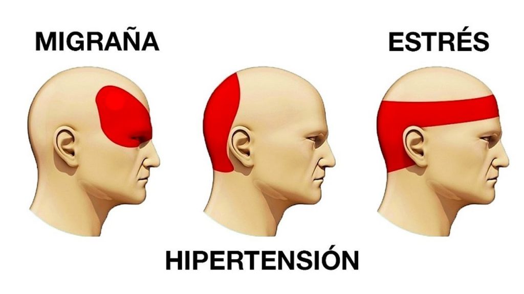 dolor de cabeza
